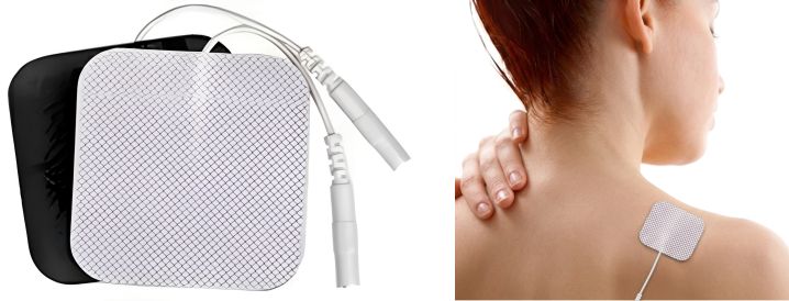 エレクトロポレーションの電極パッド