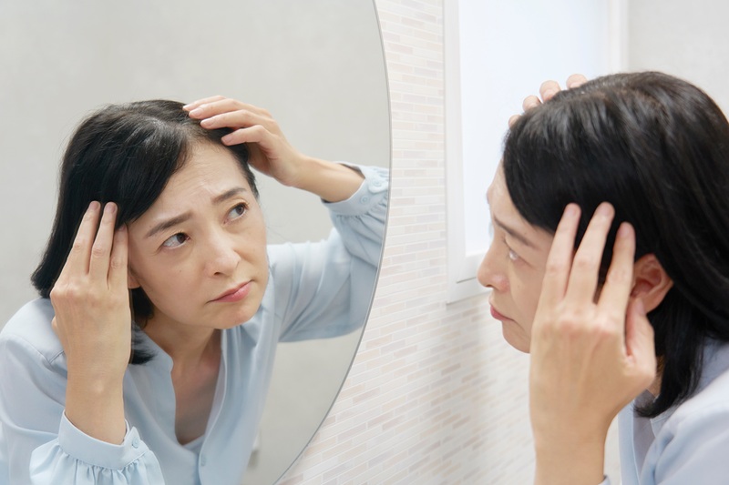 エクソソームで脱毛症をケアできる？具体的な効果とメリット