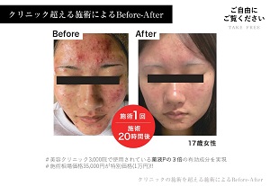 Before After